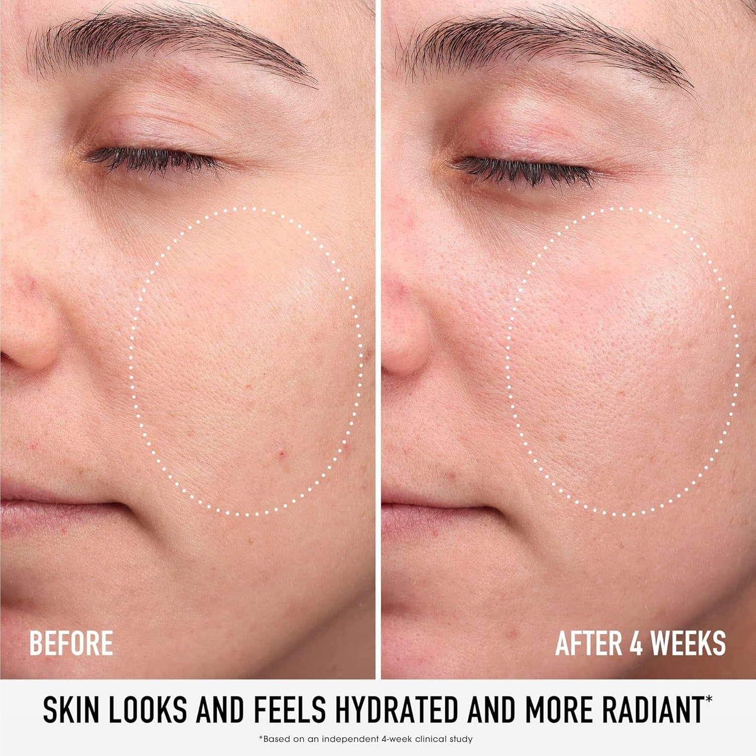 Skin Rescue Pure Moisture Serum