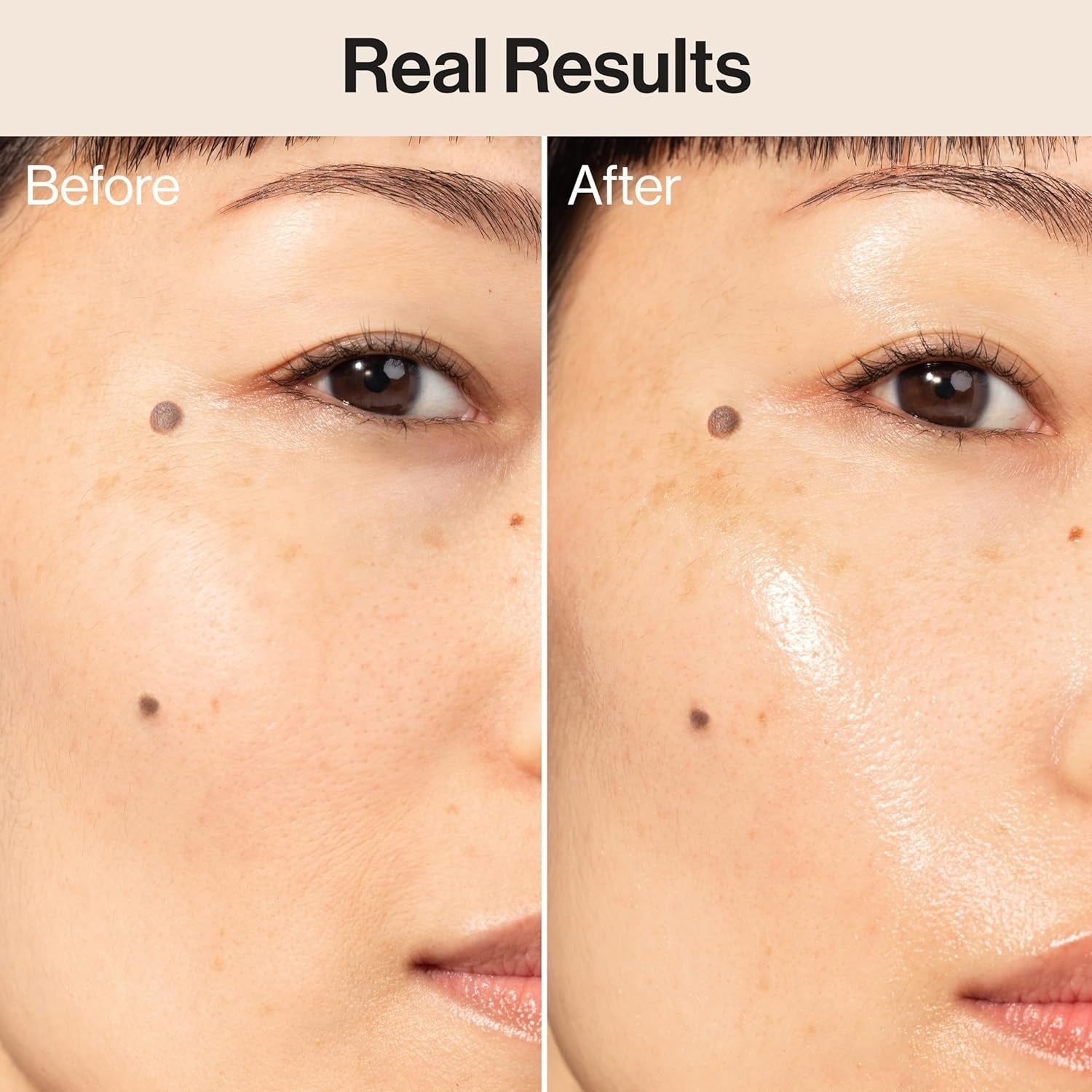Hydrogel Cream - 2 Types of Hyaluronic Acid + Squalane