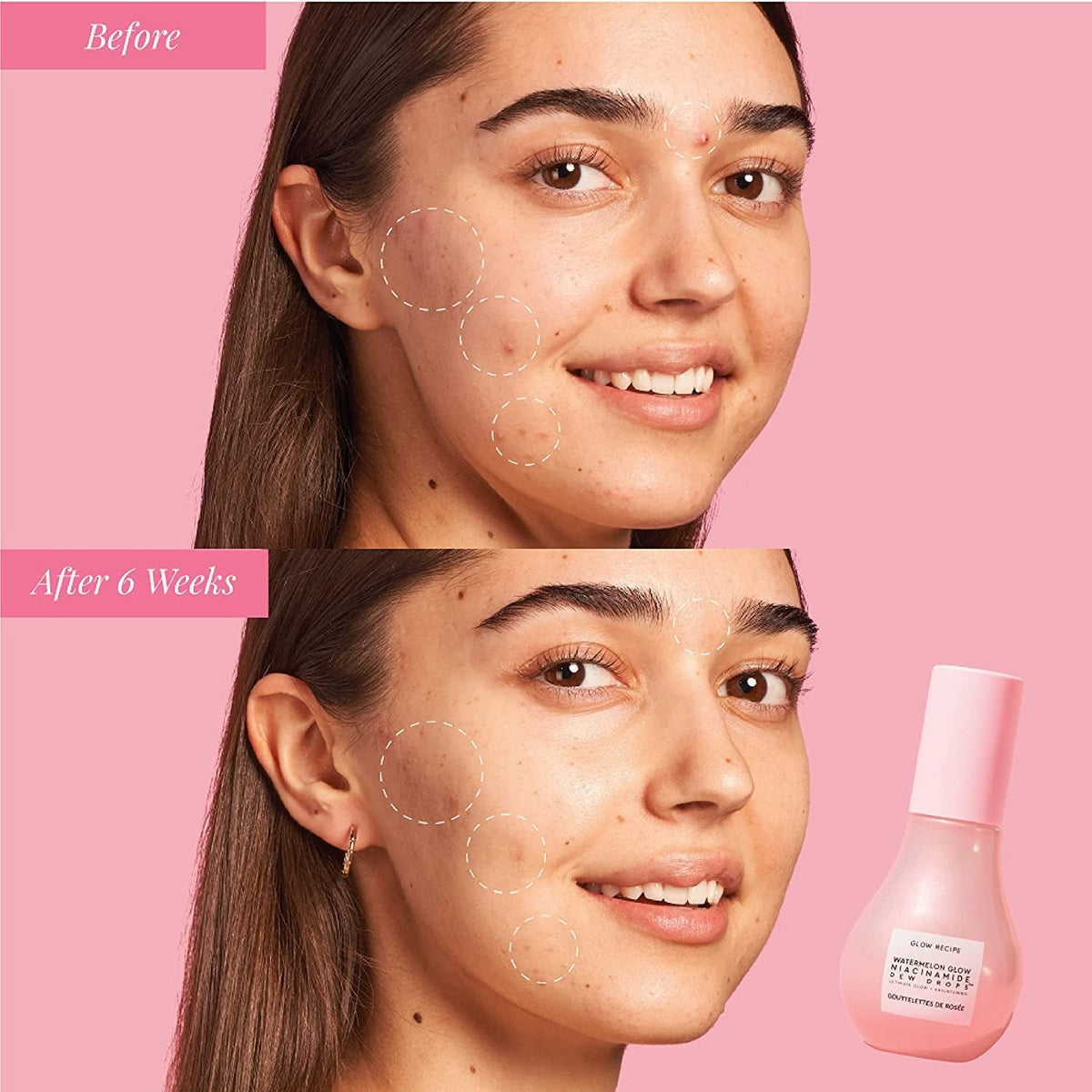 Watermelon Mini Niacinamide Dew Drops Highlighting Serum