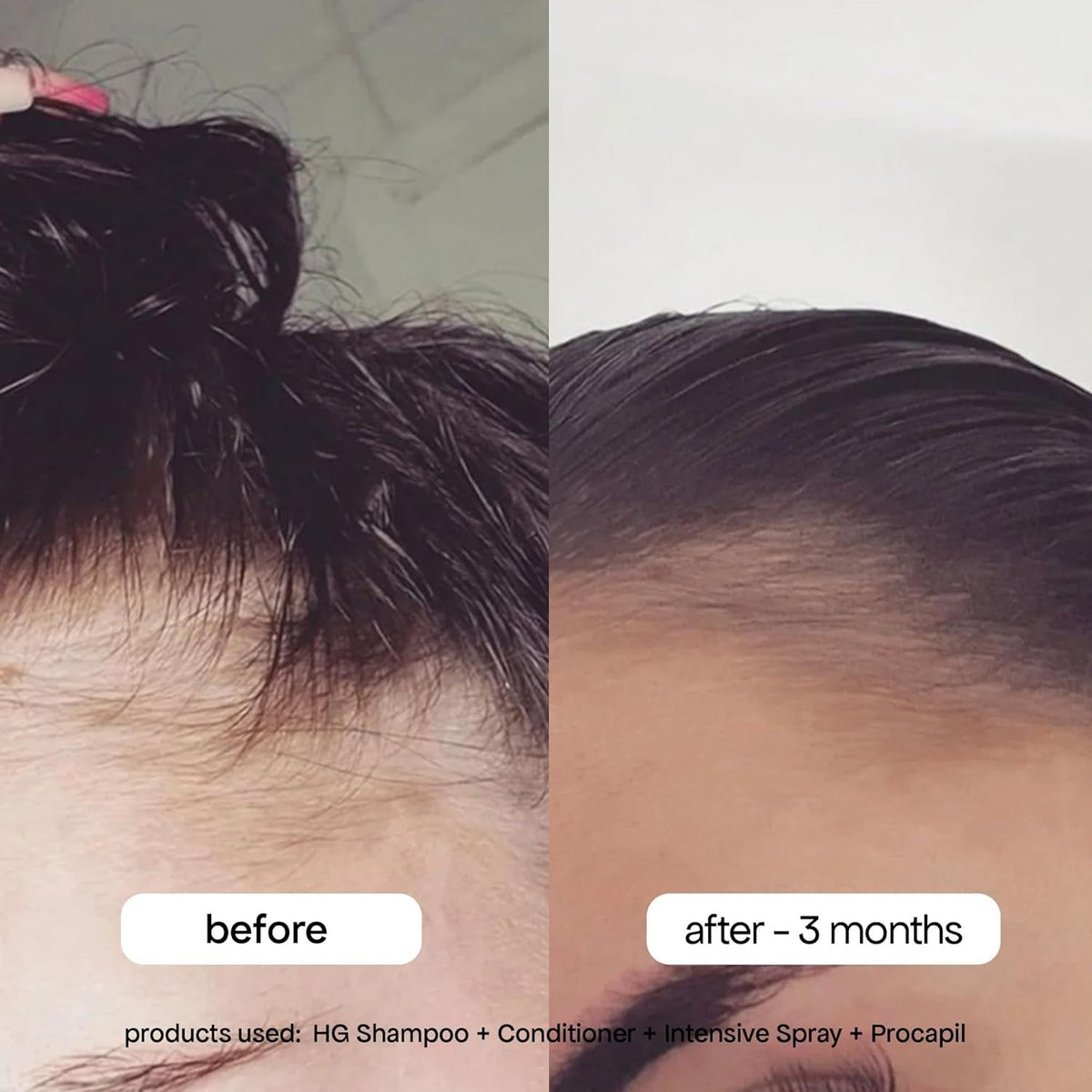 Intensive Growth Spray