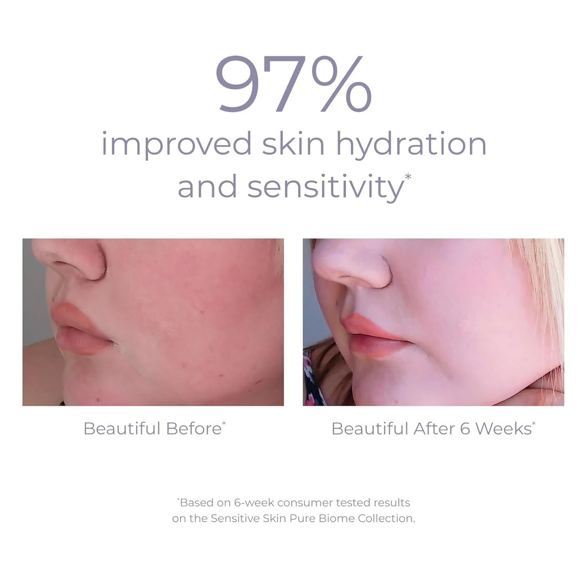 Pure Biome Balancing Serum
