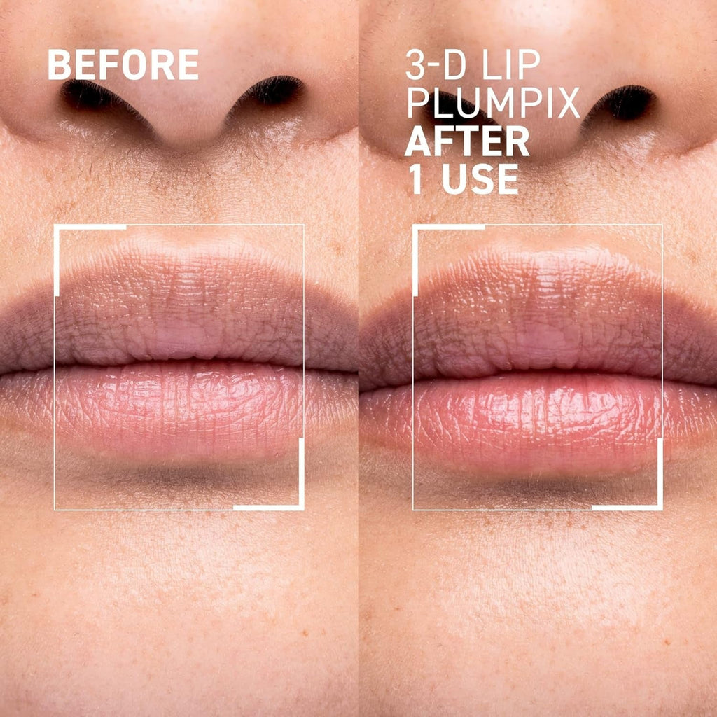 3-D Lip Plumpfix