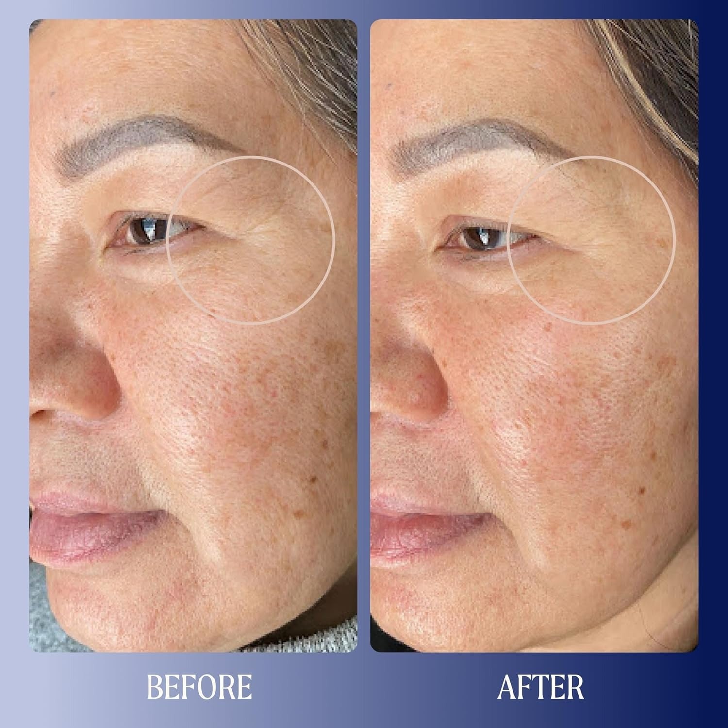 Dreamwave 2% Bio-Retinoid Overnight Renewal Serum