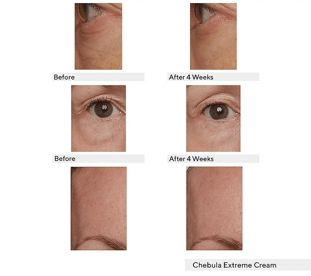 Supersize Chebula Serum With Discovery Set