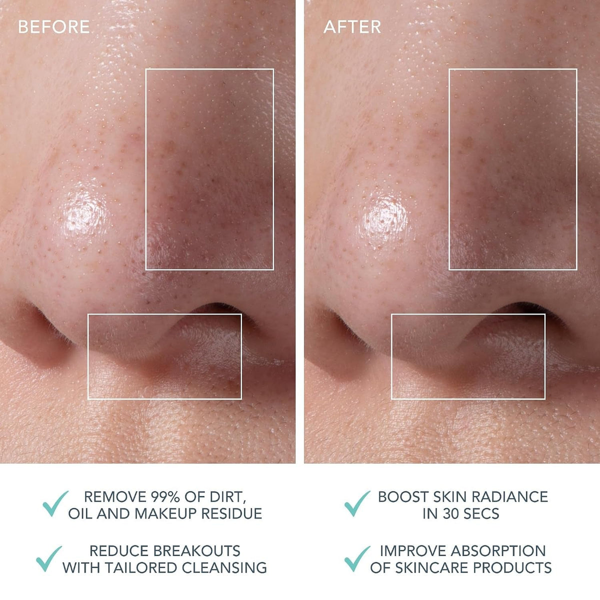 Luna Mini 3 Smart Facial Cleansing & Firming Device - Mint