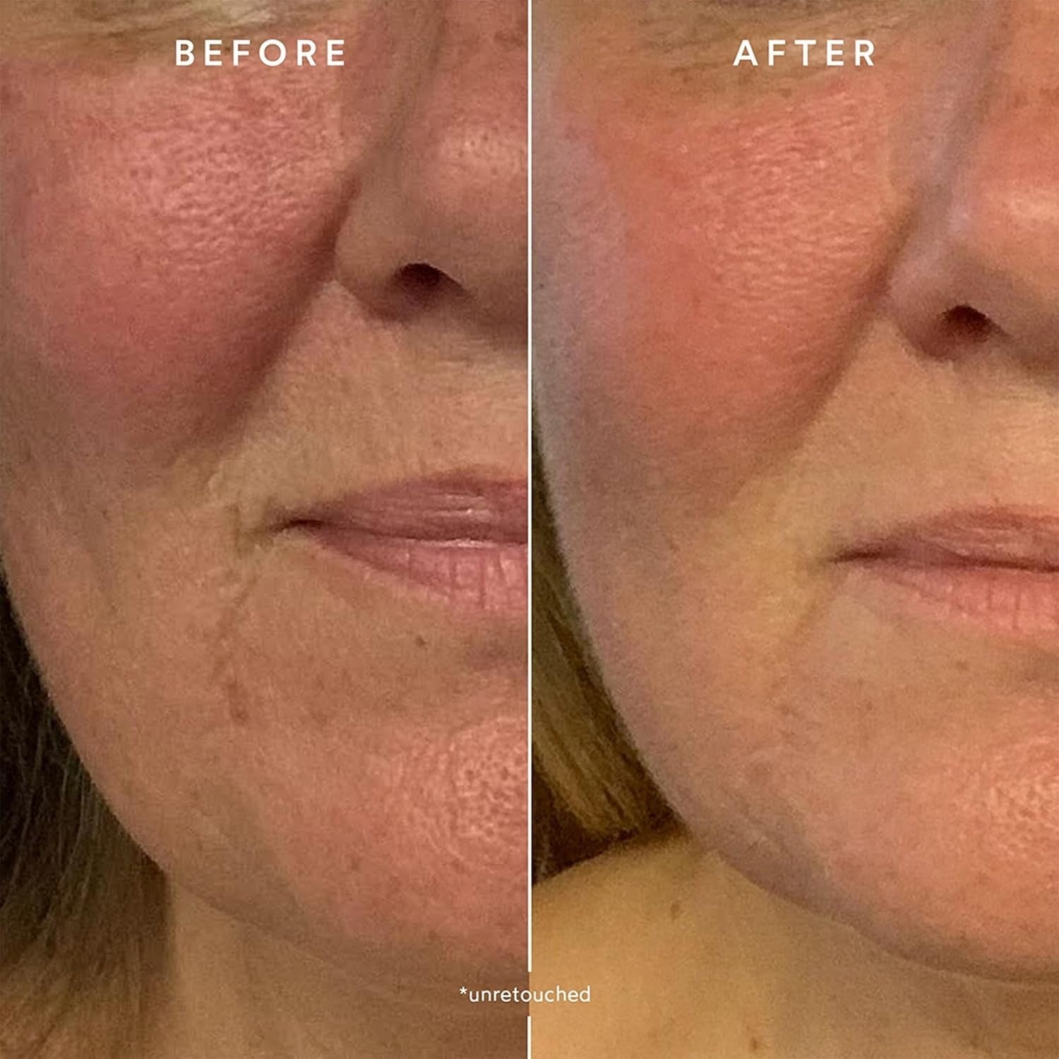 Renew Repair Nightly Treatment Serum
