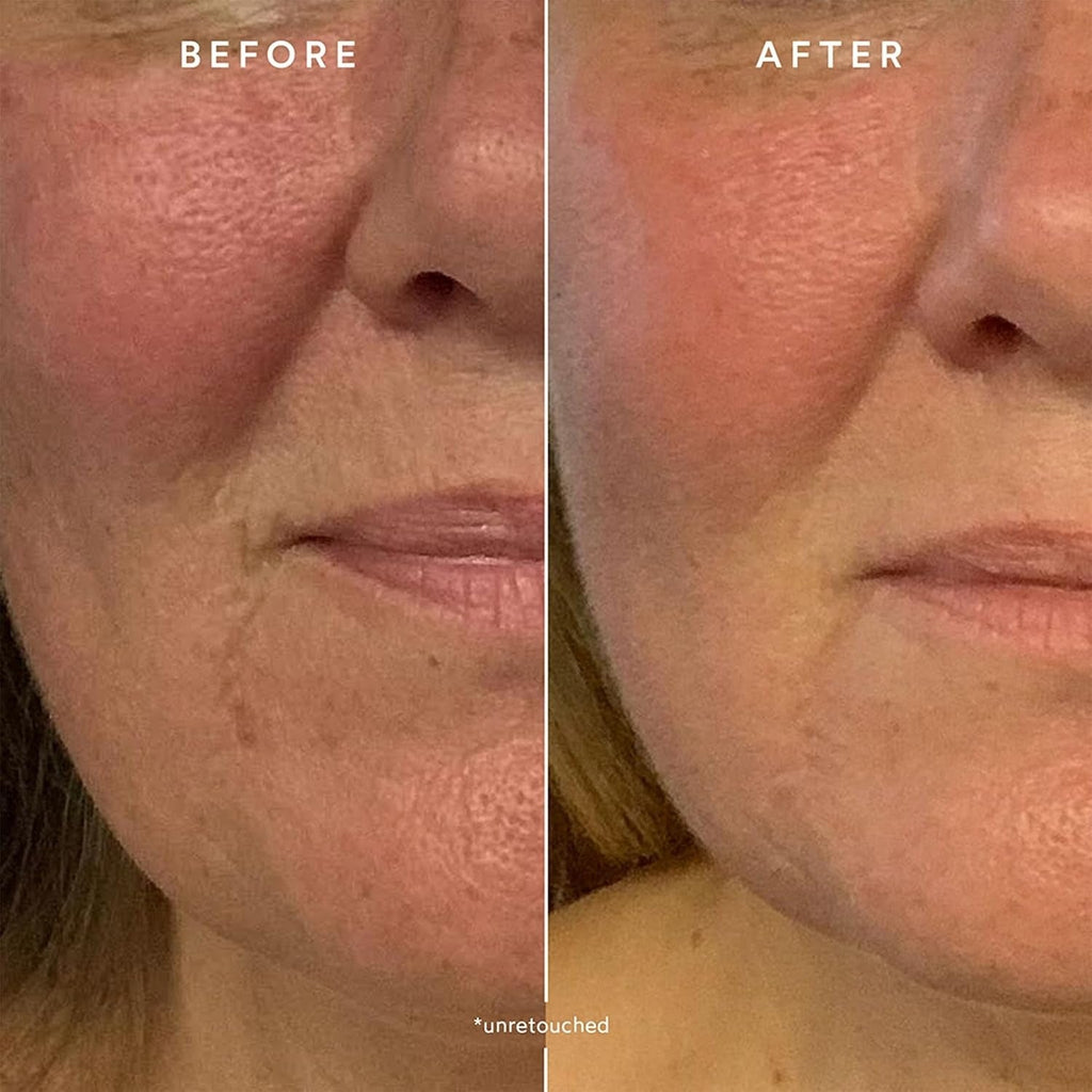 Renew Repair Nightly Treatment Serum
