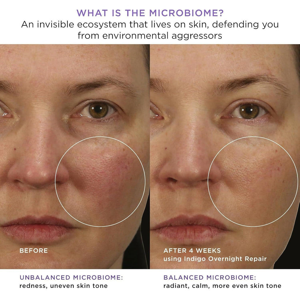 The Indigo Overnight Repair