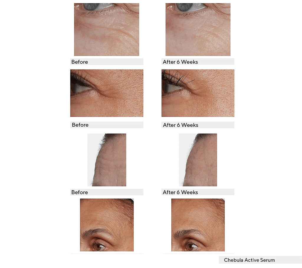 Supersize Chebula Serum With Discovery Set