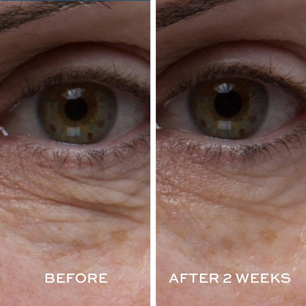 Peptide4 Eye Recovery Cream