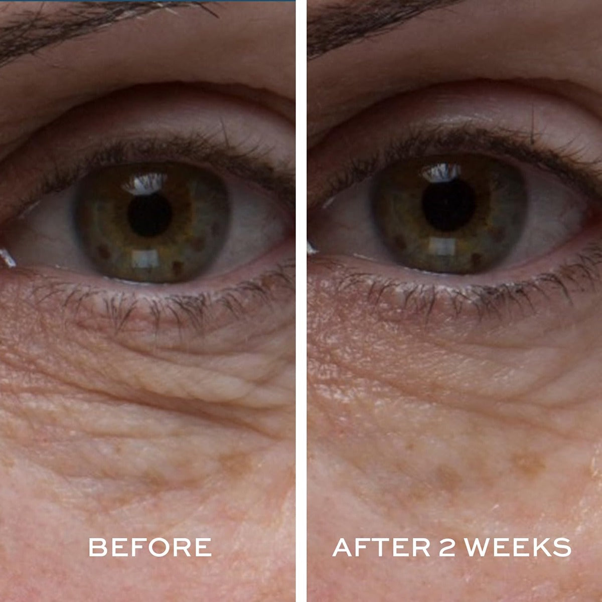 Peptide4 Eye Recovery Cream